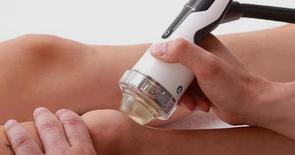 Focused Shock Wave Therapy in Mumbai Bandra