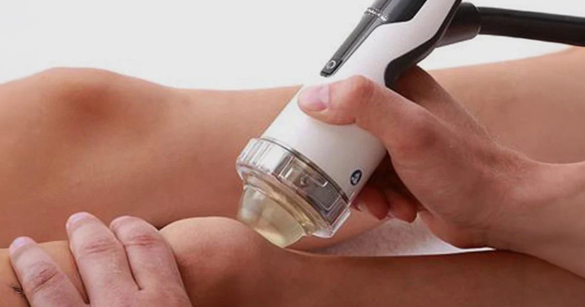 Focused Shock Wave Therapy in Mumbai Bandra